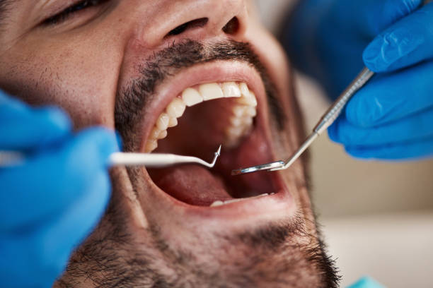Best Emergency Broken Tooth Repair in Albany, TX