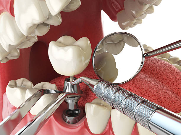 Best Emergency Treatment for Toothache in Albany, TX